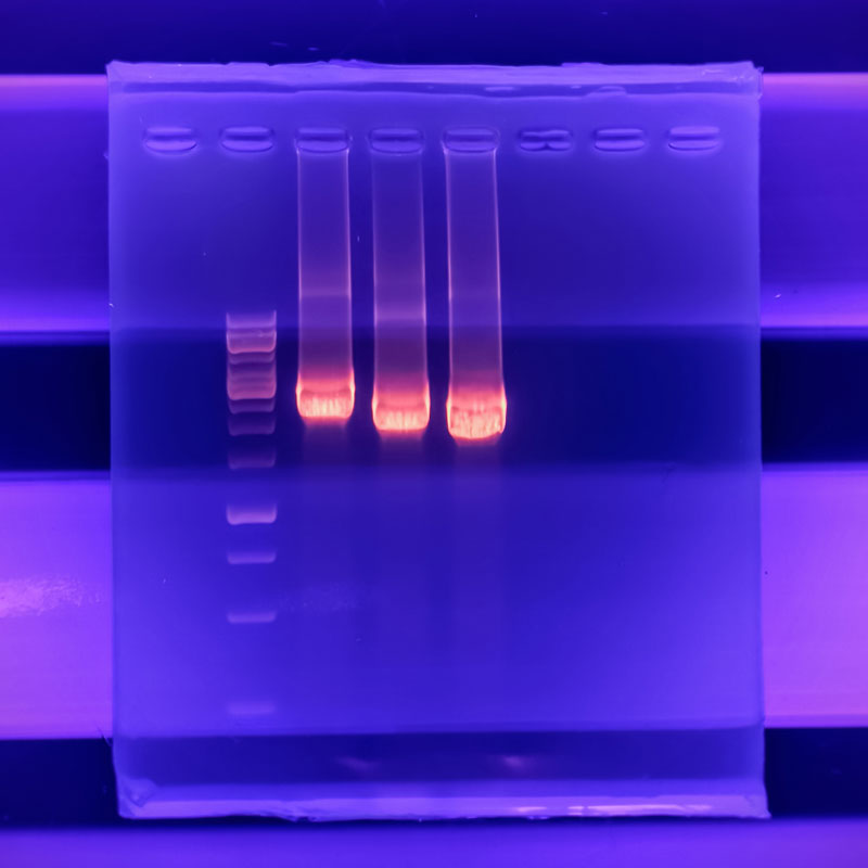 Resultado de la electroforesis de gel de agarosa de productos PCR
