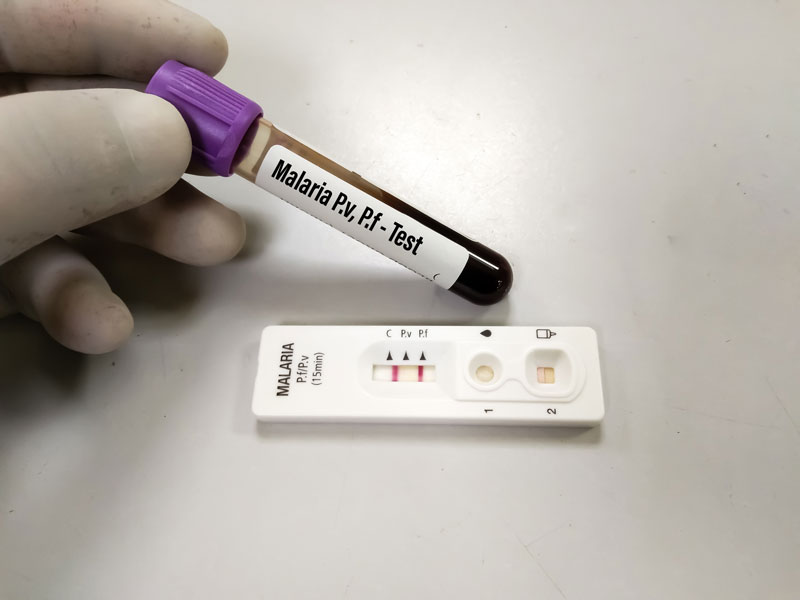 Test para la identificación de Malaria