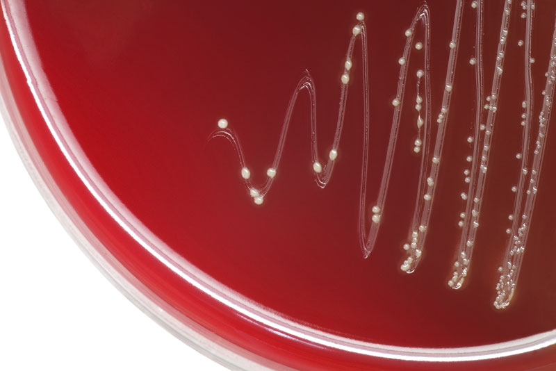 Streptococcus pneumoniae cultivado en agar sangre