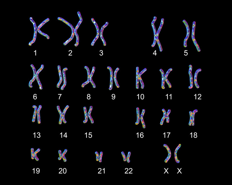 Cariograma de cromosomas humanos de mujer