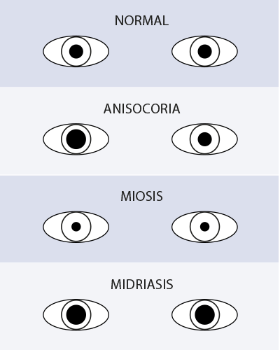 Esquema que muestra los reflejos pupilares.