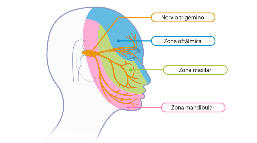 Ubicación del nervio trigémino. 