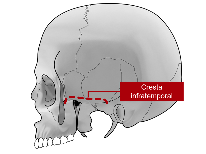 Cráneo en donde se observa la cresta infratemporal.