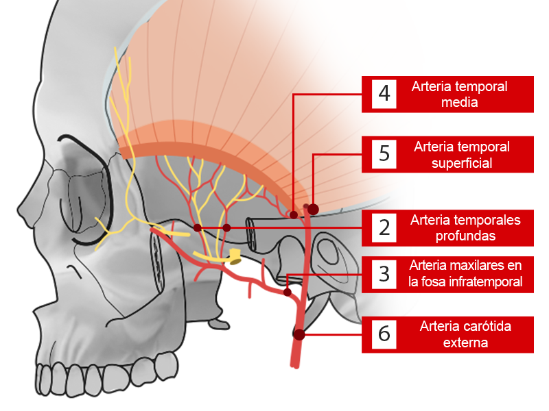 Vista lateral del cráneo que señala las arterias de la fosa temporal.