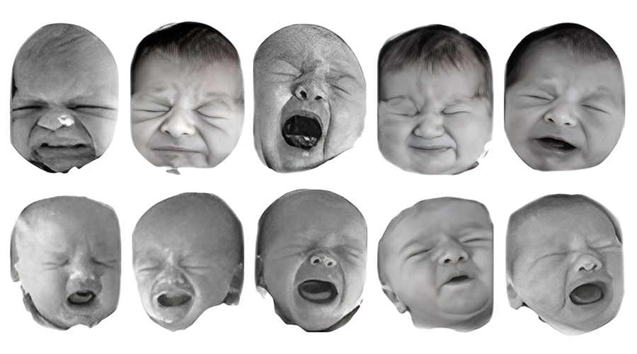 Caras de bebés con expresiones de  dolor