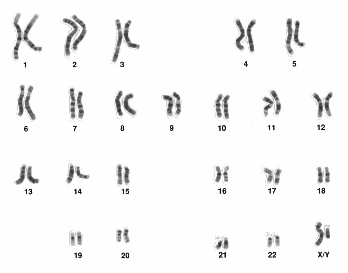 Cromosomas humanos