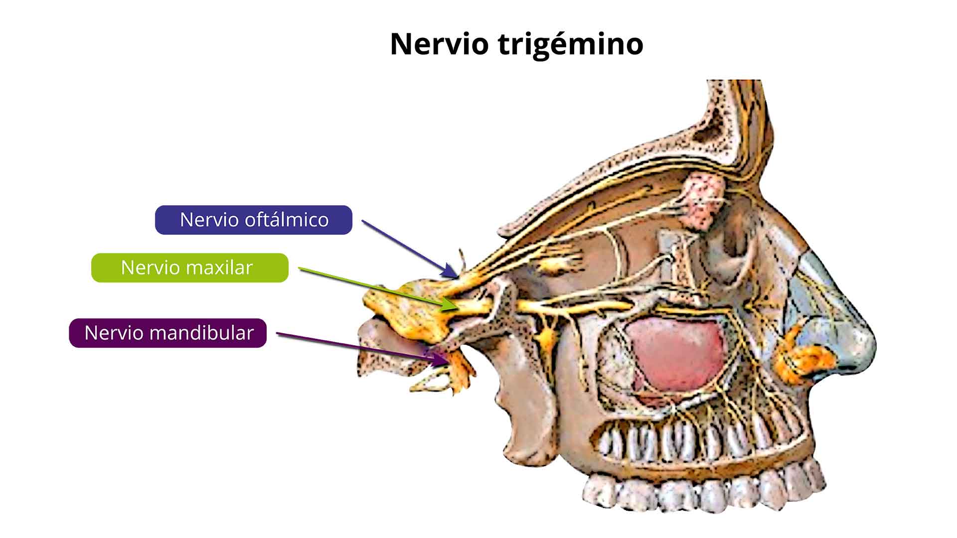 Ubicación del nervio oftálmico, maxilar y mandibular en un rostro humano.