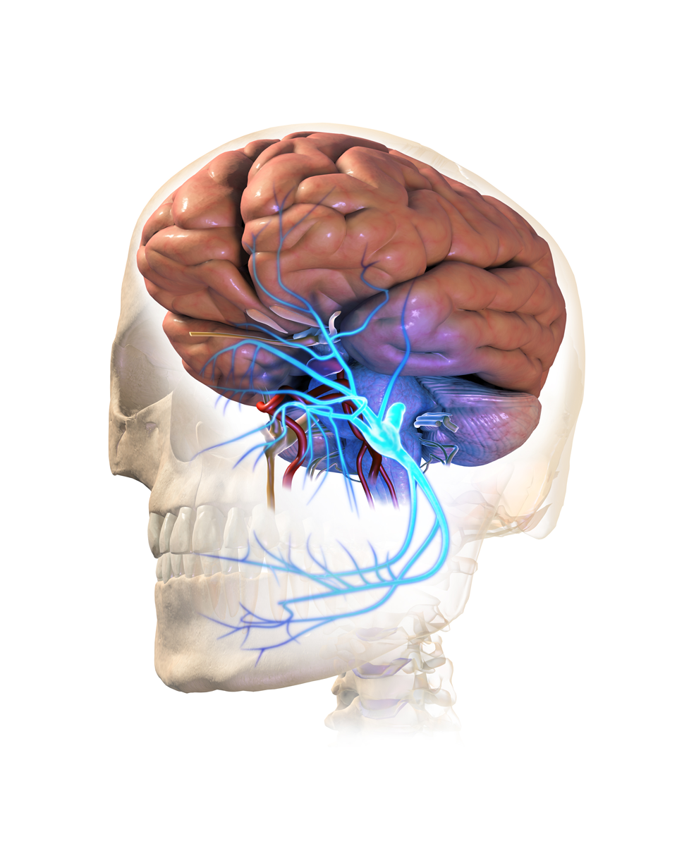 Neuralgia del trigémino.