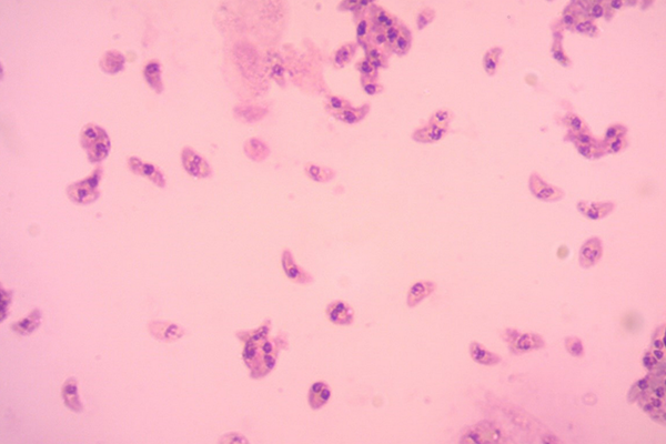 Uapa Ciclo Biológico De Toxoplasma Gondii 3359