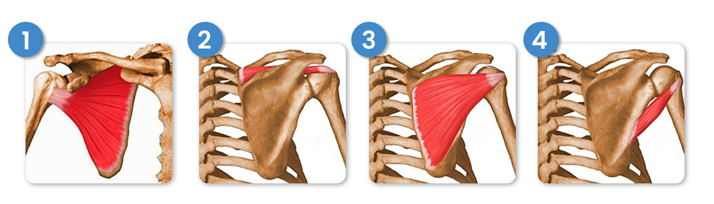 Ilustración que muestra las zonas subescapular, infraespinosa, supraespinosa y del redondo menor.