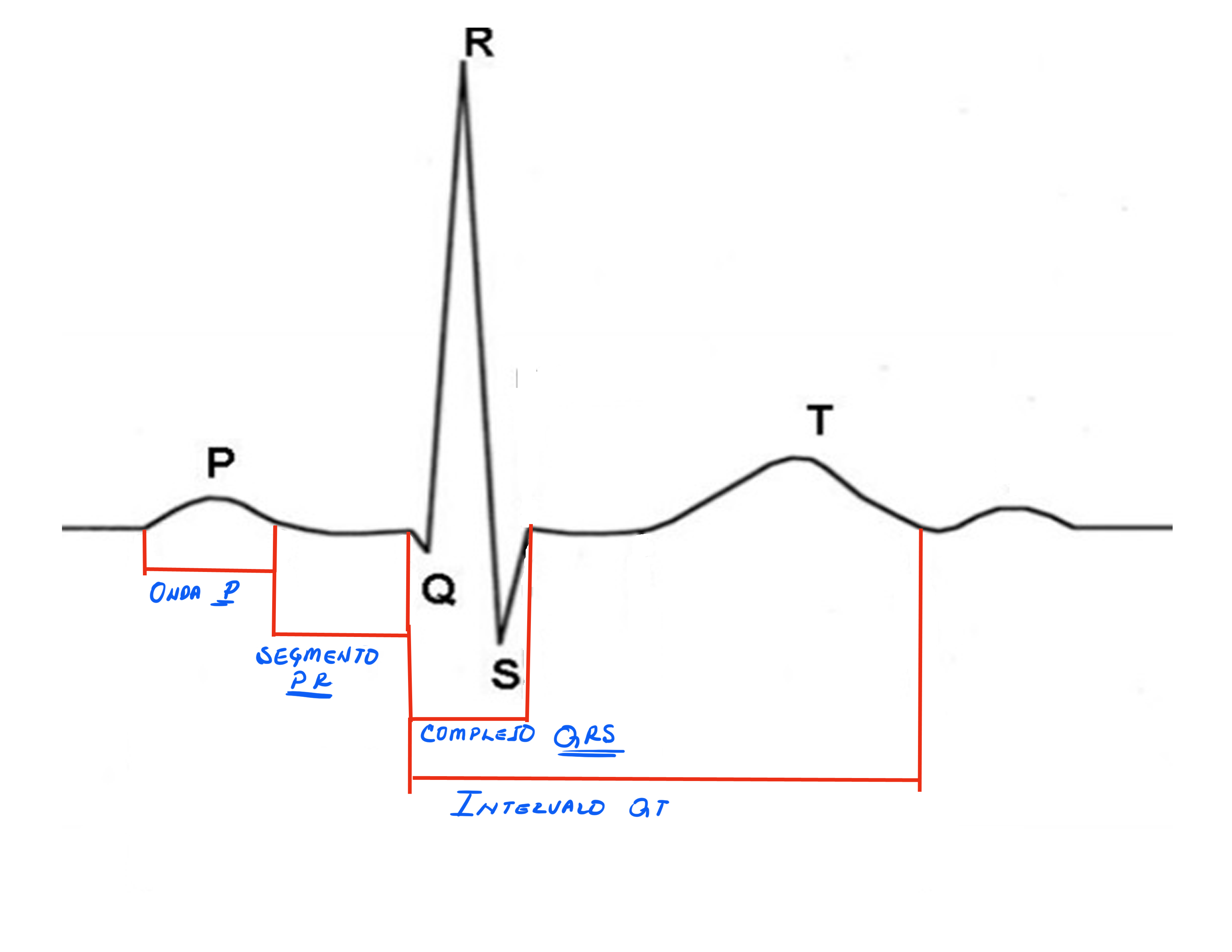 Indicaciones del electrocardiograma