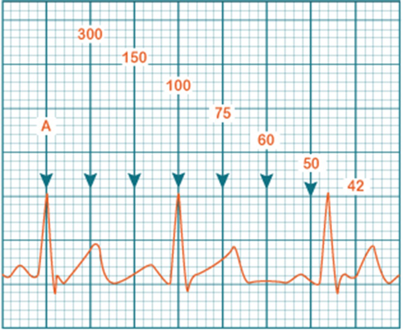 FC-ECG